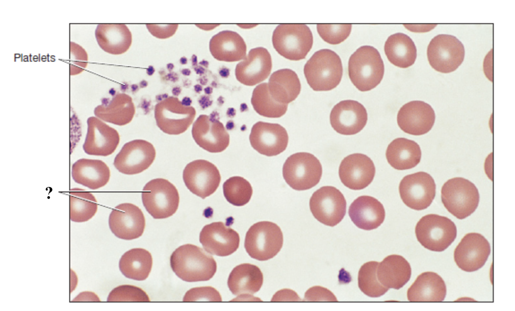 <p>red blood cells that function to carry oxygen throughout the body using hemoglobin and to pick up carbon dioxide from tissues and unload it in the lungs</p><ul><li><p>most numerous blood cells with average of 44% of total blood volume</p></li><li><p>reddish-pink color, biconcave shape, absent nucleus and most organelles</p></li></ul><p></p>