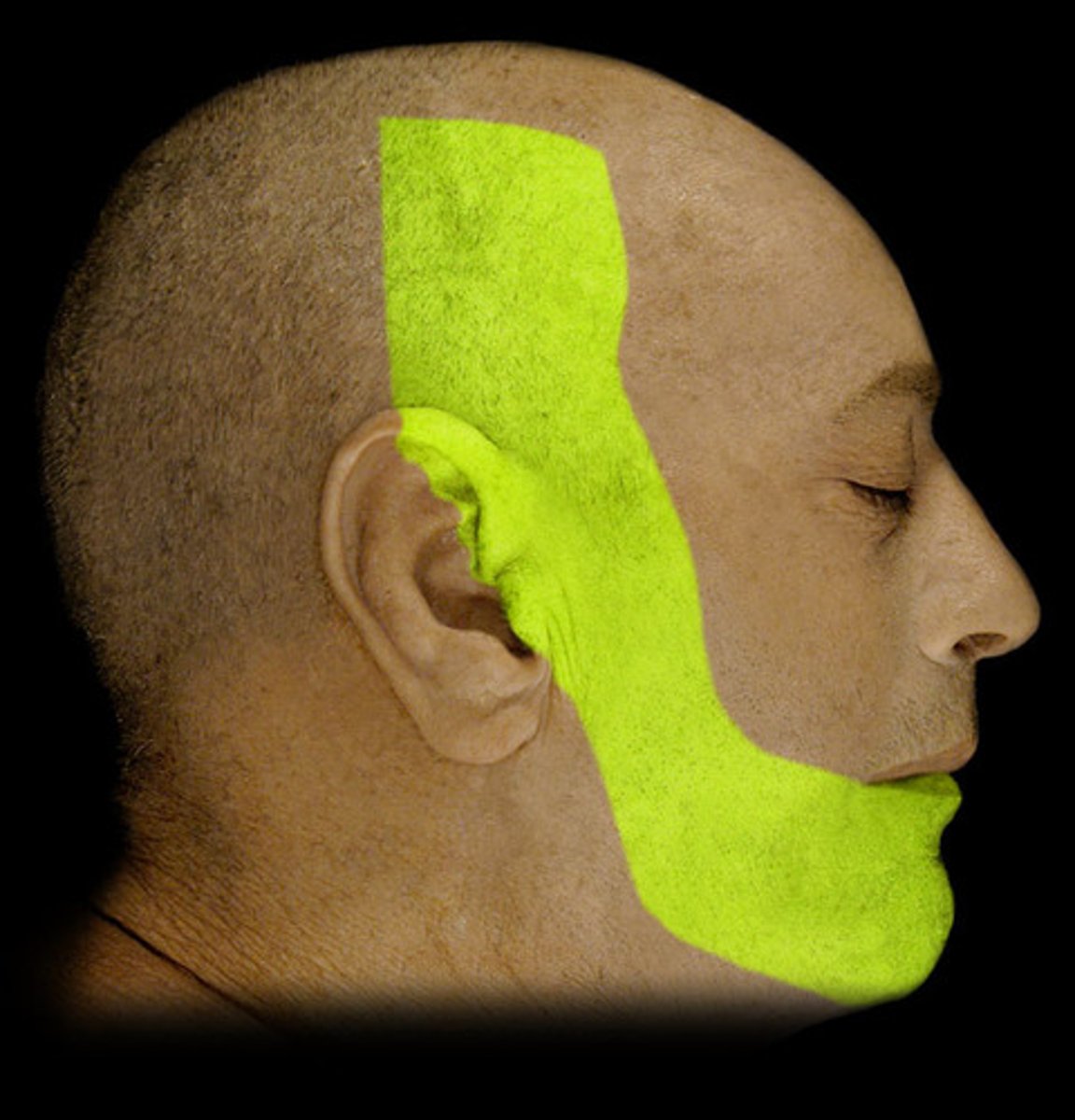 <p>Mixed; passes through foramen ovale</p>