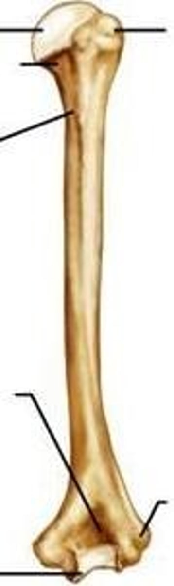 <p>ID bone</p>