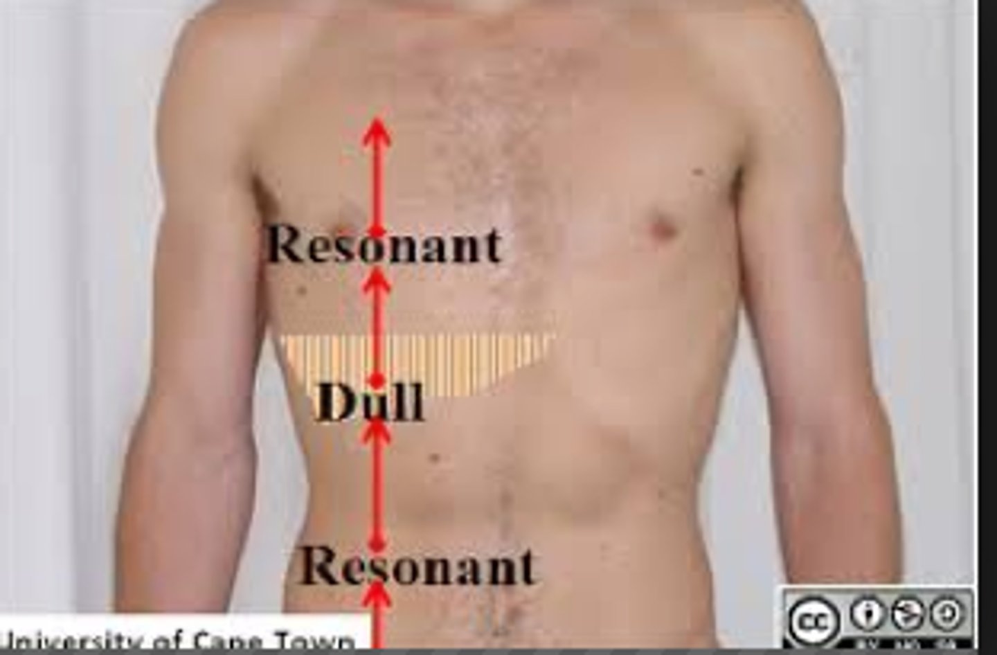<p>A</p><p>The liver is located in the right upper quadrant and would elicit a dull percussion note.</p>