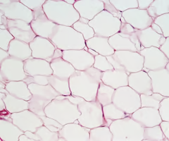 <p>Adipose Tissue </p>