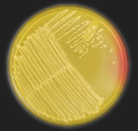 <p>MSA — What is the selective ingredient in this medium?</p>