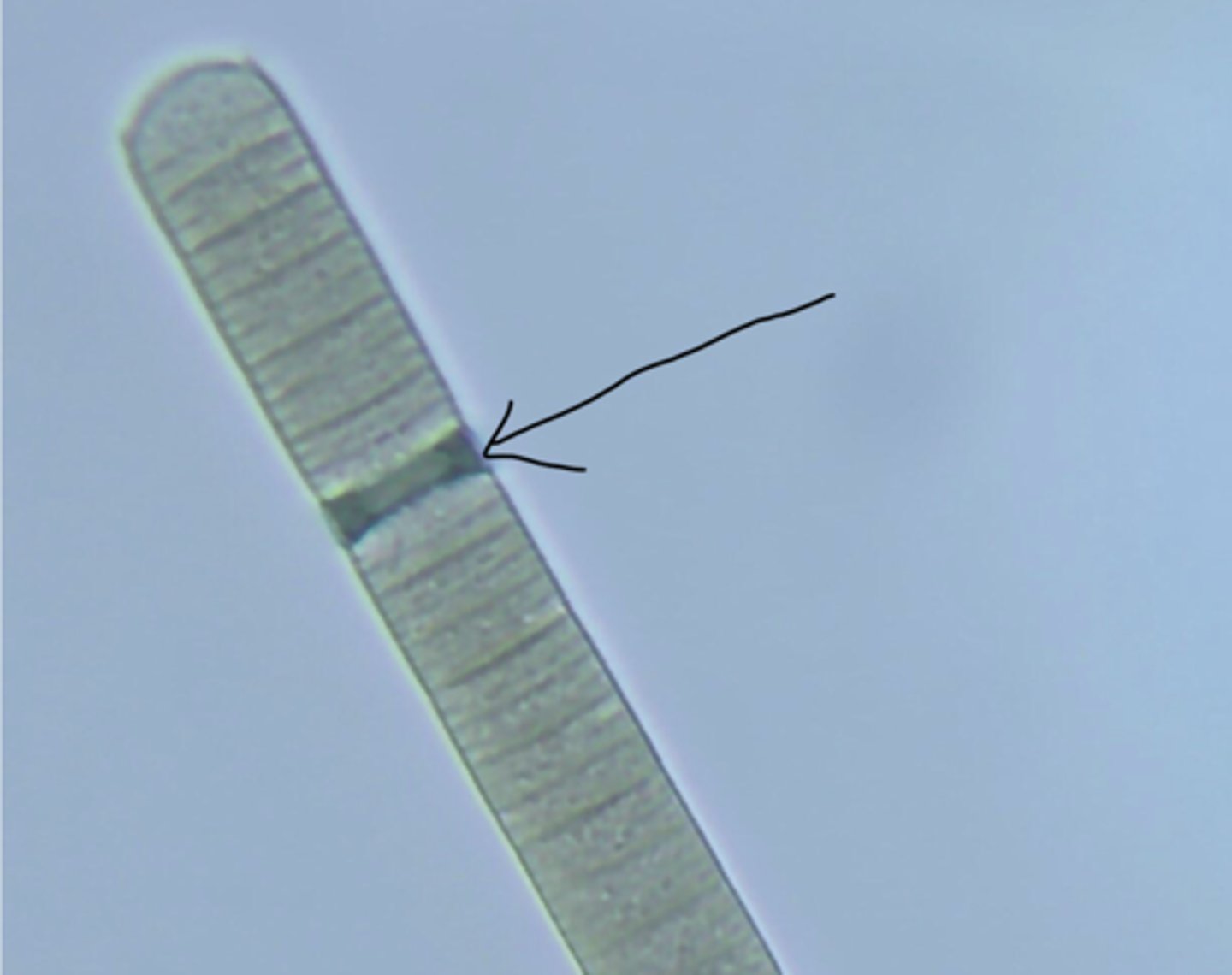 <p>Note the separation discs in the uppermost filament: these are formed by the death of cells at intervals along a filament, the dead cells filling with mucilage. Filaments will eventually fragment at these separation discs into separate segments called hormogonia or hormogones, a form of asexual reproduction</p>