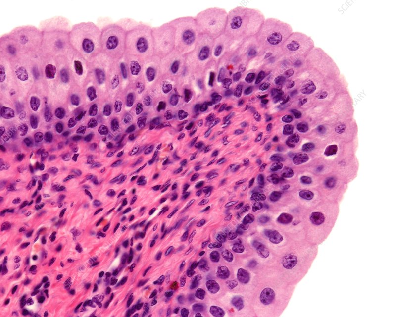 <p>transitional epithelium</p>