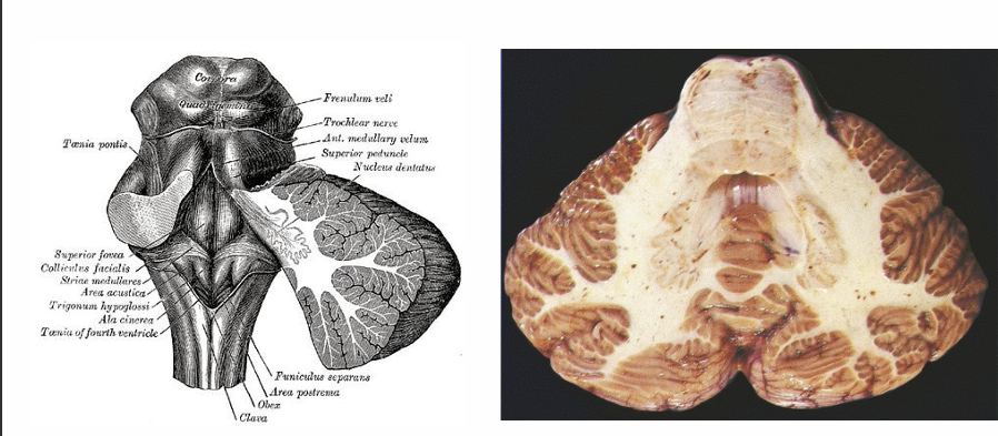 <p>Where is the dentate nucleus located </p>
