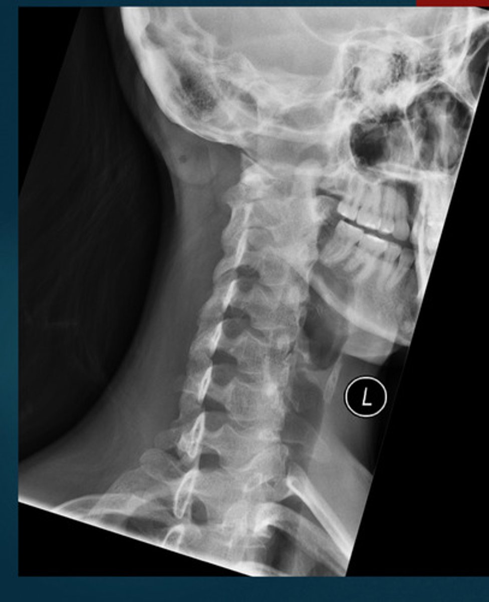 <p>What projection view is this?</p>