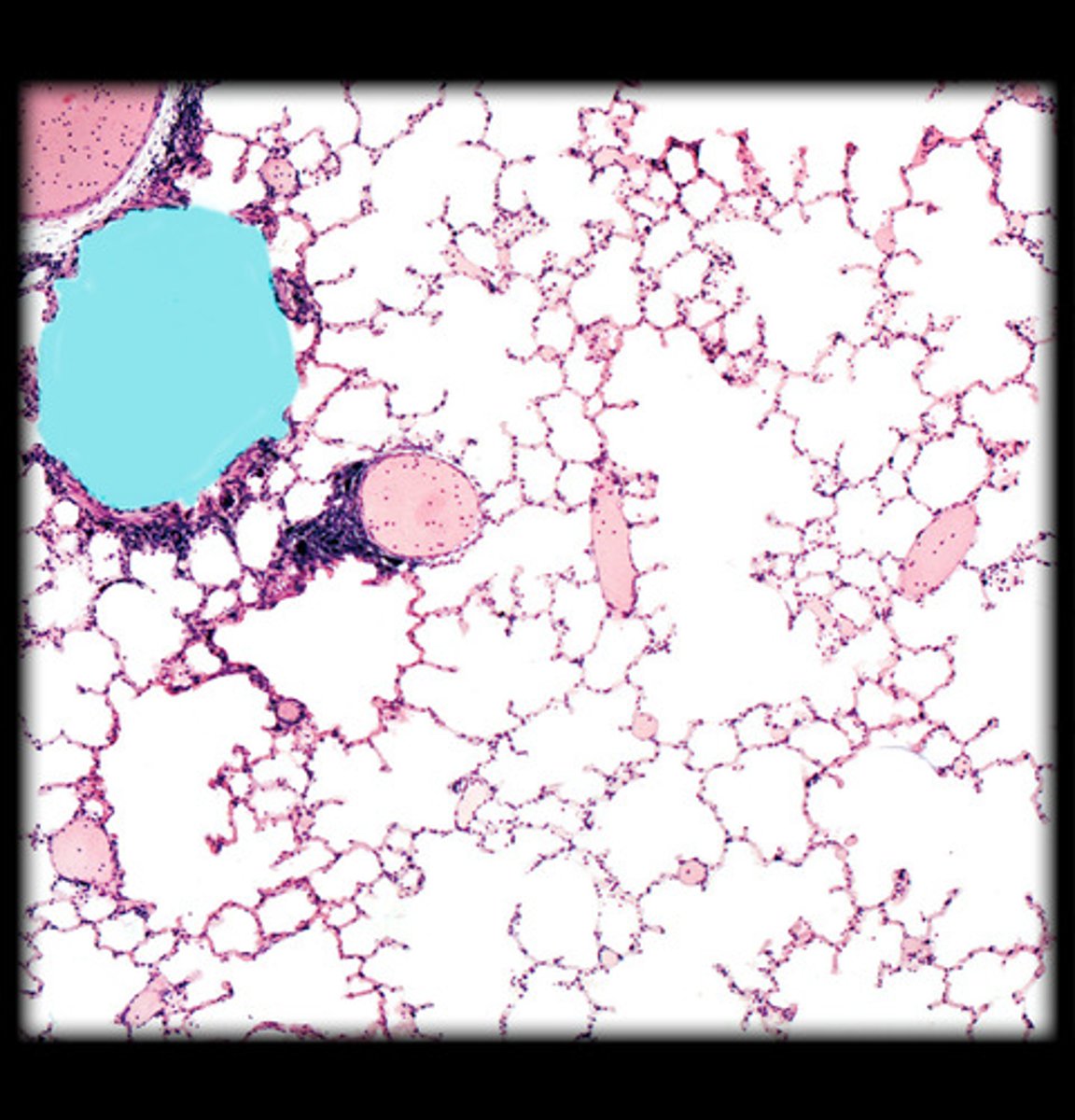 <p>what is highlighted HM in this image?</p>