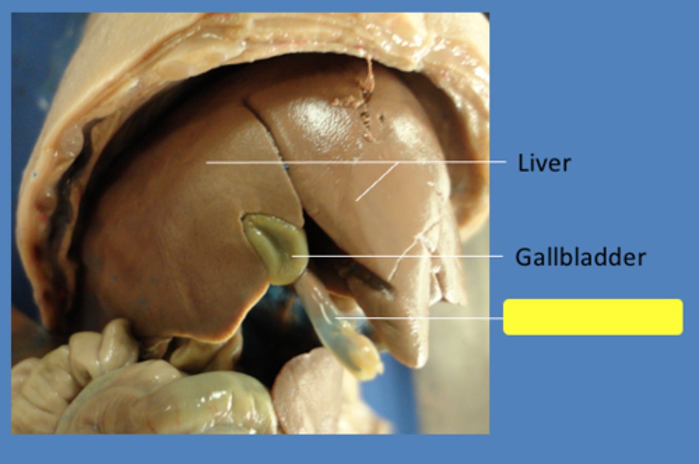 <p>carry oxygenated blood from placenta to fetus</p>