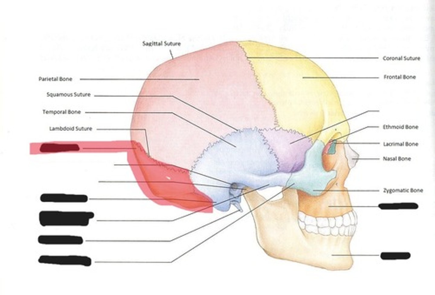 <p>Occipital bone</p>