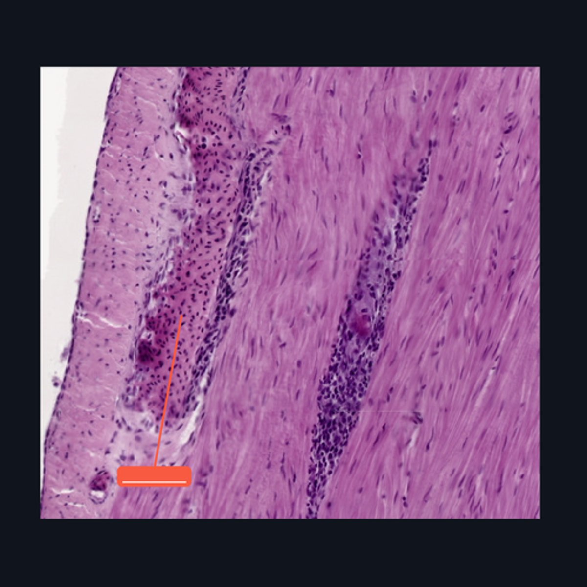 <p>Identify the structure</p>