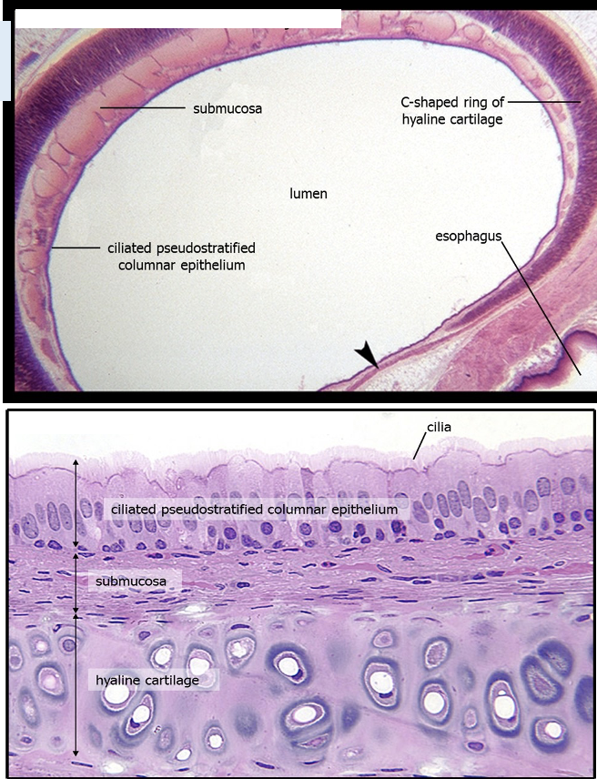 Identifying features:

•C-shaped ring of hyaline cartilage

•Ciliated pseudostratified columnar epithelium