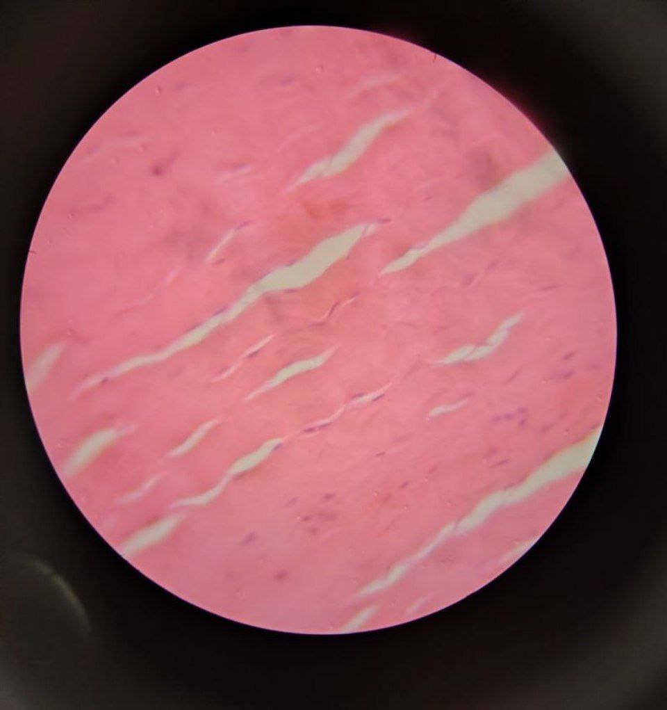 <p>Identify the tissue and mention one site</p>