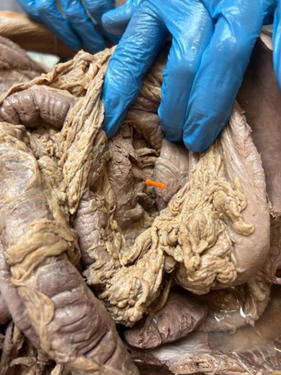 <p>superior mesenteric artery</p>