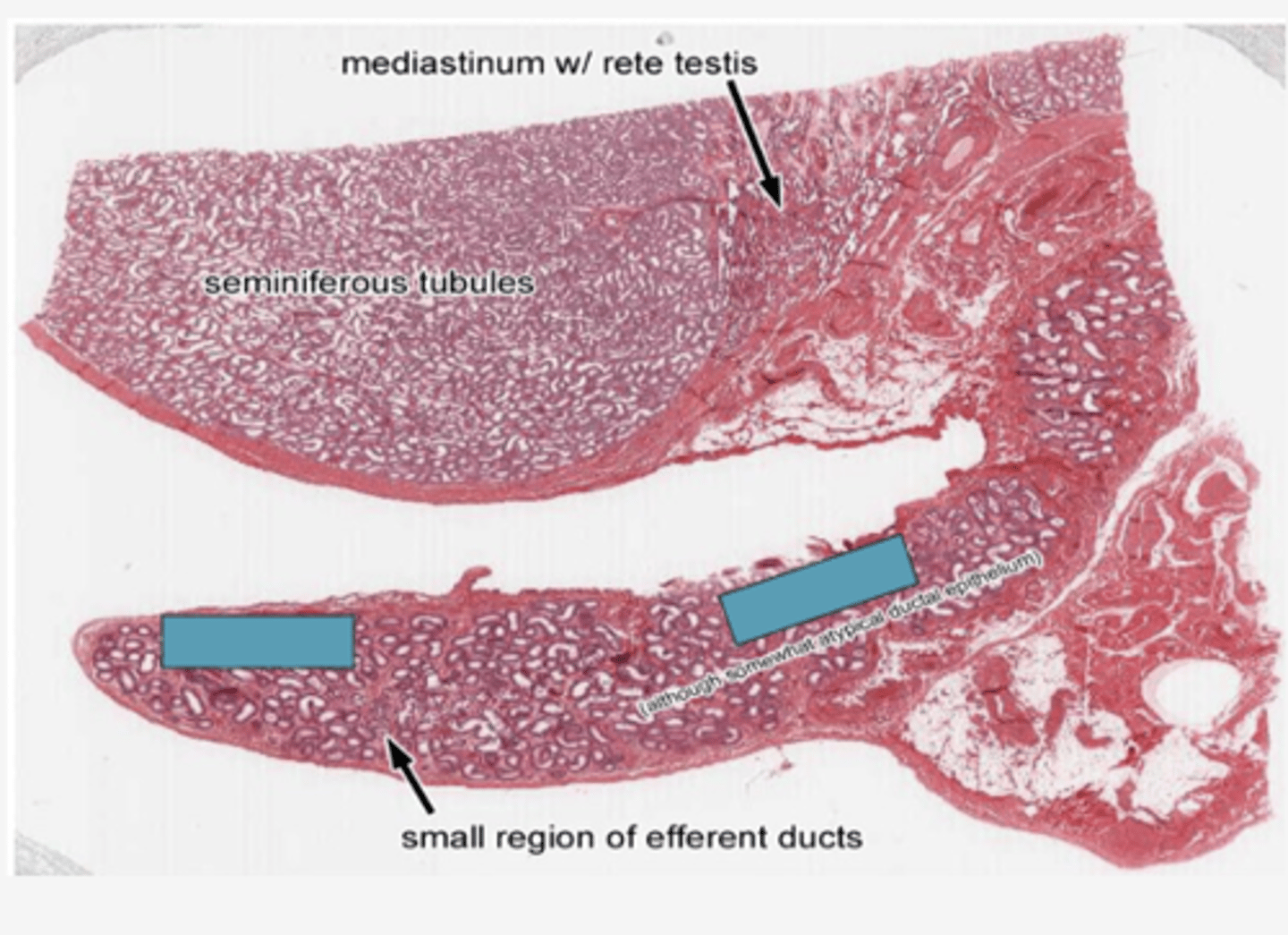 <p>Identify the organ</p>