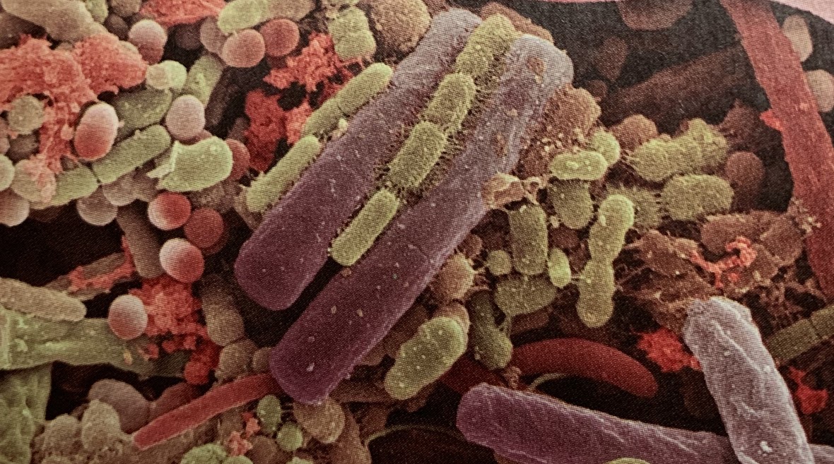 <p>This images is a scanning electron micrograph of a microbial community from a human tongue.</p><p>Most of the microorganisms shown are ___ .</p>