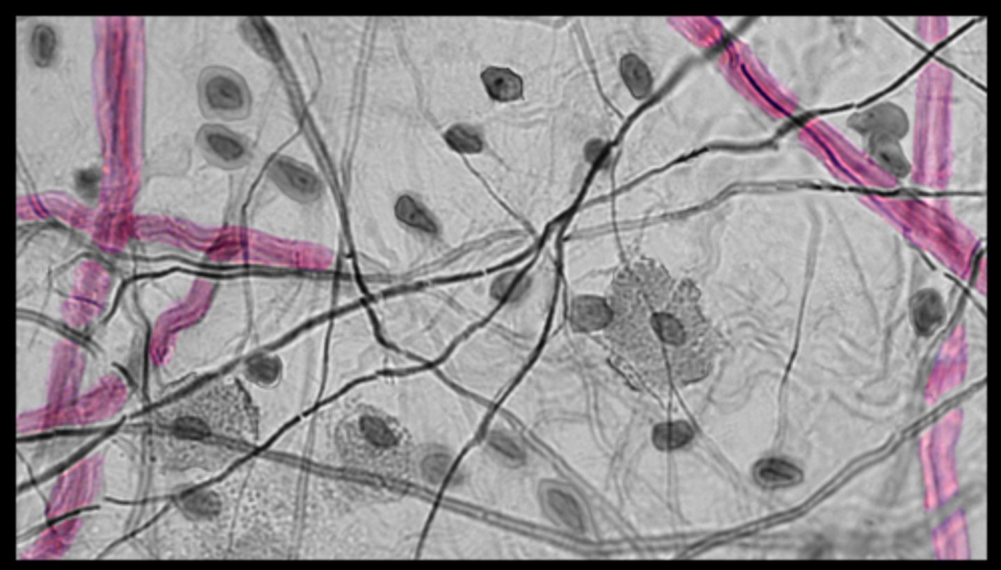 <p>most common</p><p>high tensile strength</p><p>looks like rope</p>