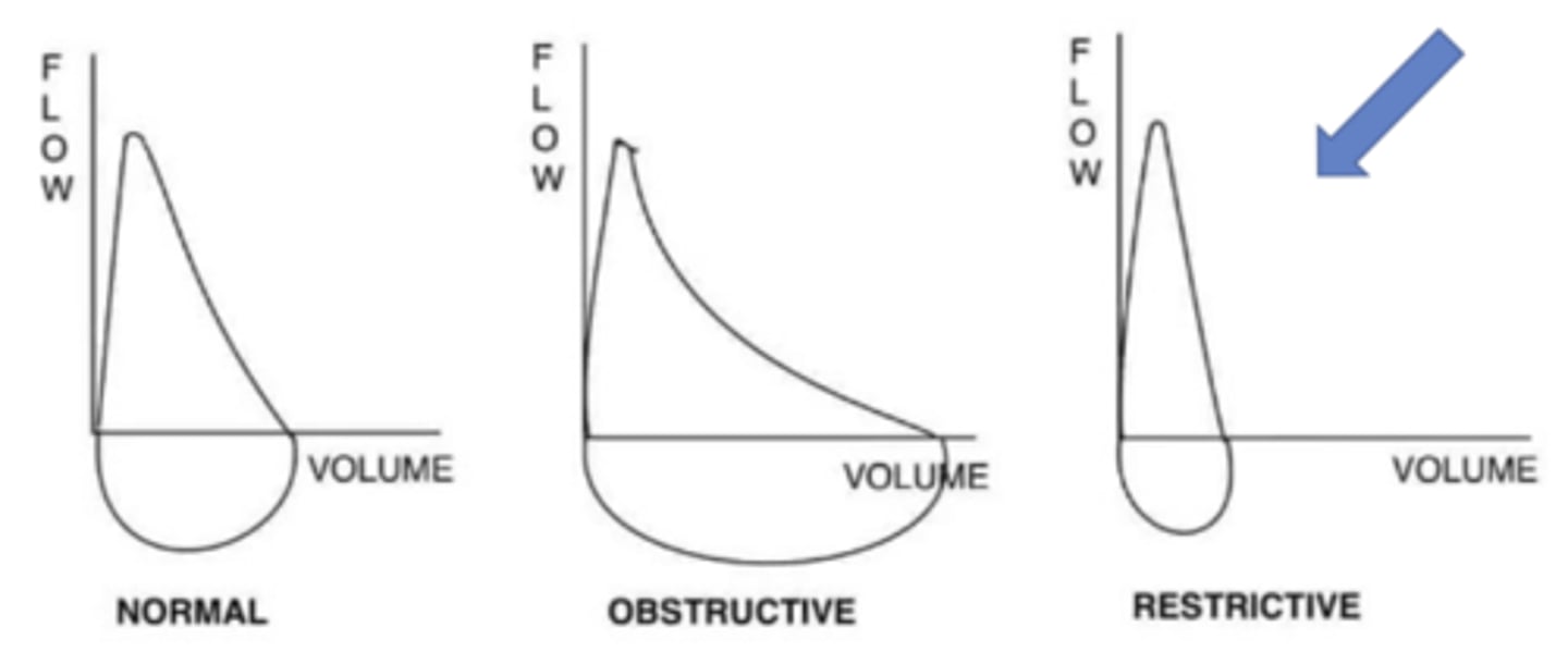 <p>Narrower loop due to reduced lung volumes (e.g., fibrosis, ARDS).</p>