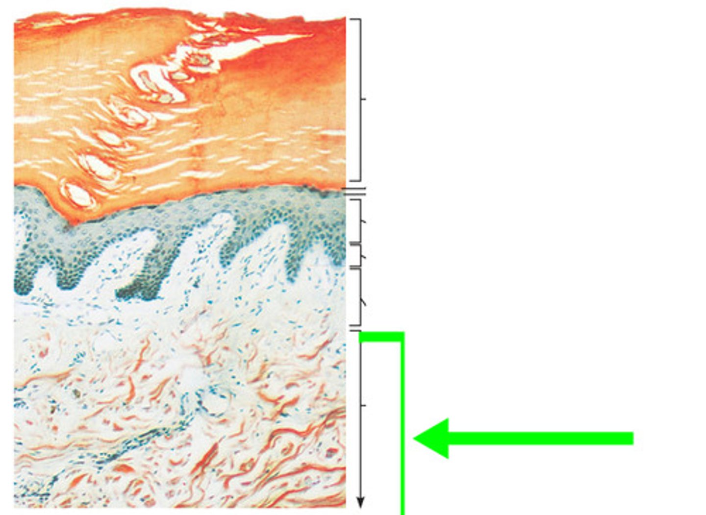 <p>Bottom 4/5 of the dermis, most is dense irregular connective tissue.</p>