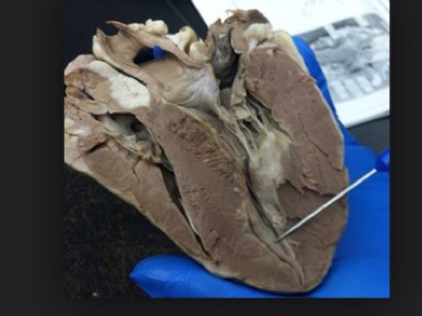 <p>Layer; layer inside the donut </p><p>cross section with circle</p>