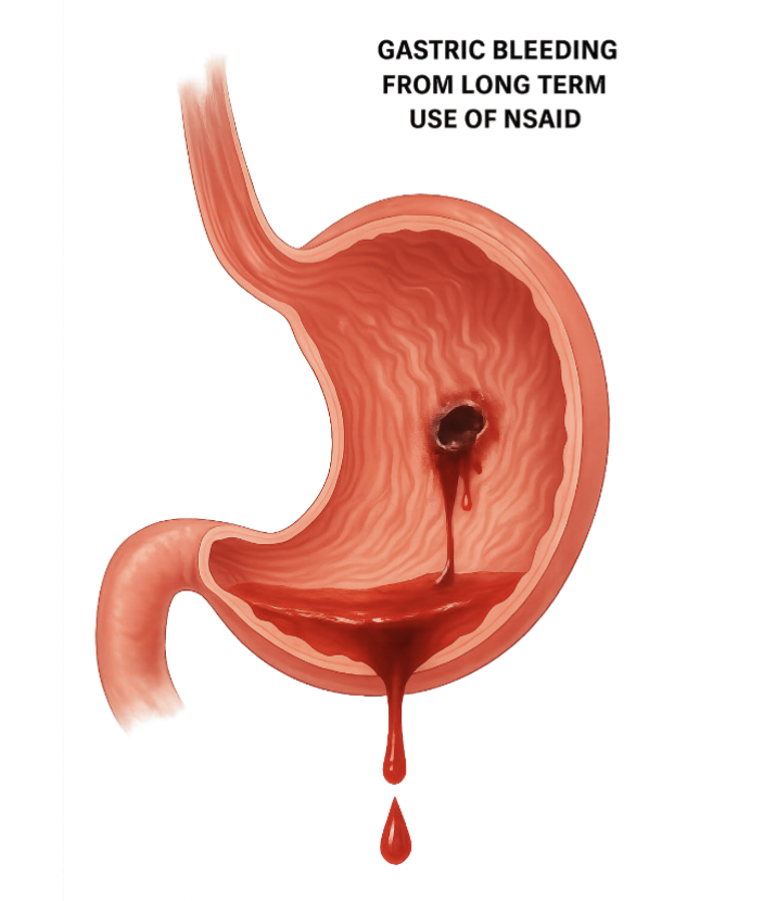<ul><li><p>Those that help maintain mucosal layer in stomach</p></li><li><p>Those that reduce gastric acid secretion</p></li></ul><p></p>