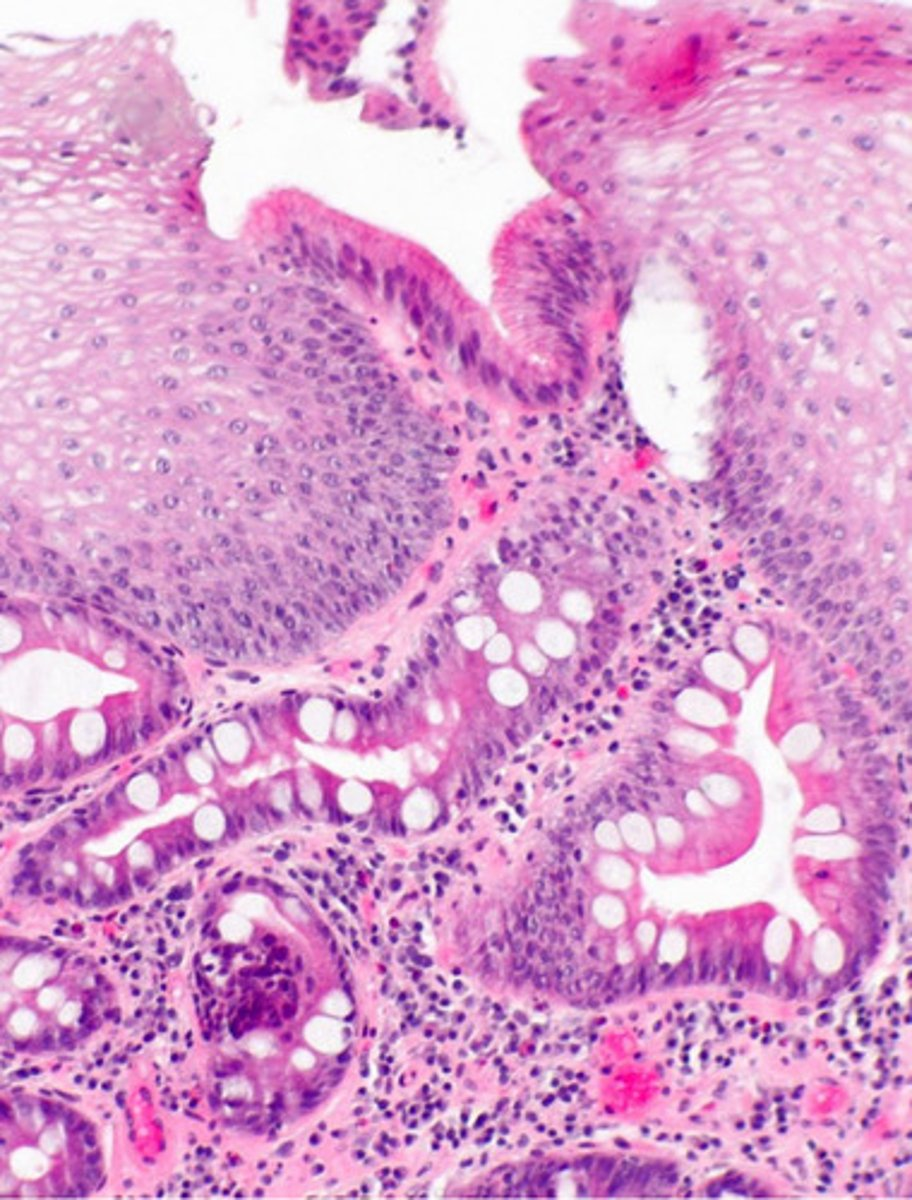<p>identify the pathology</p>