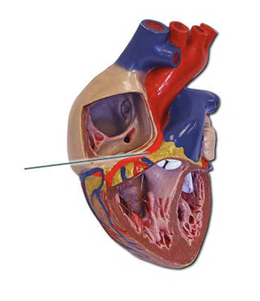 <p>identify the highlighted vessel.</p>