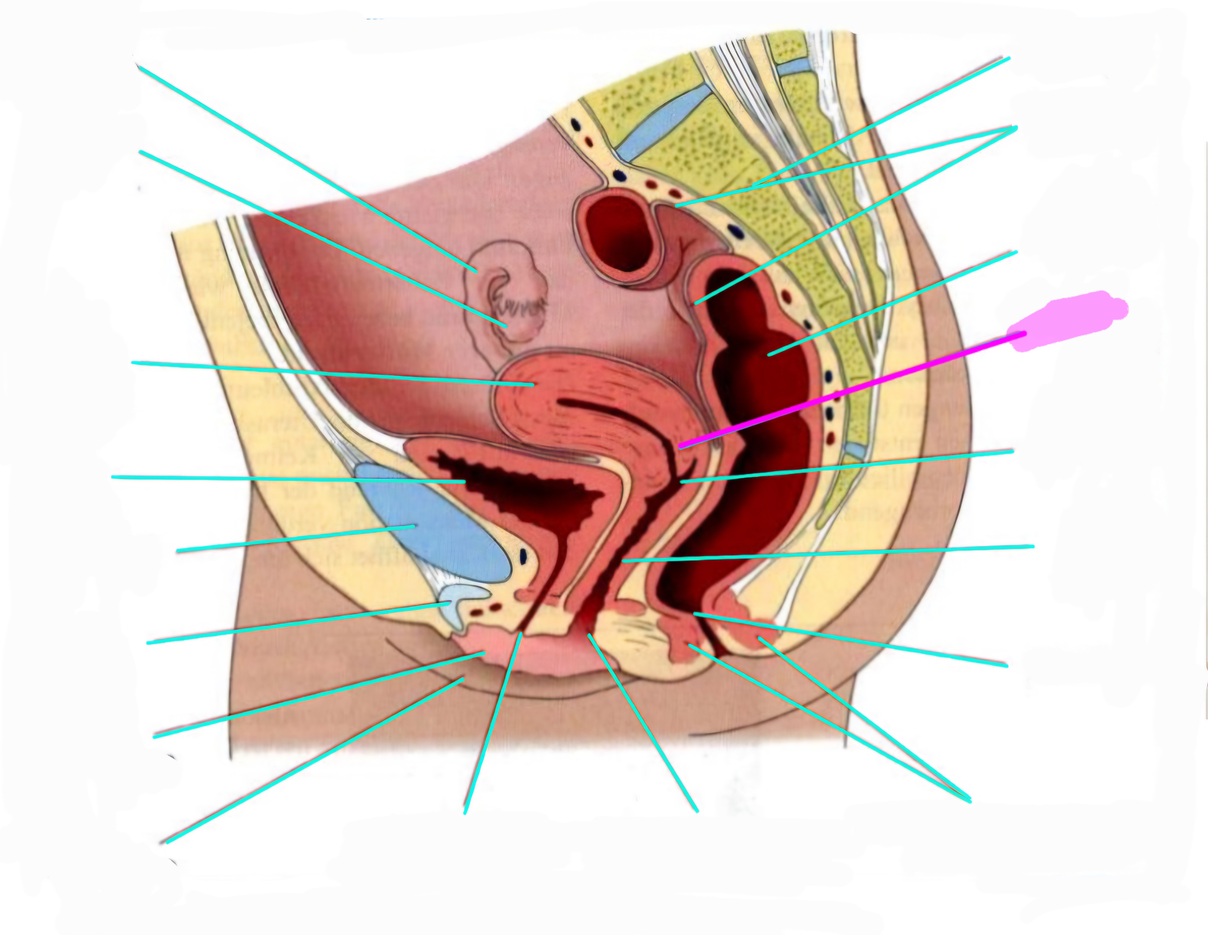 term image
