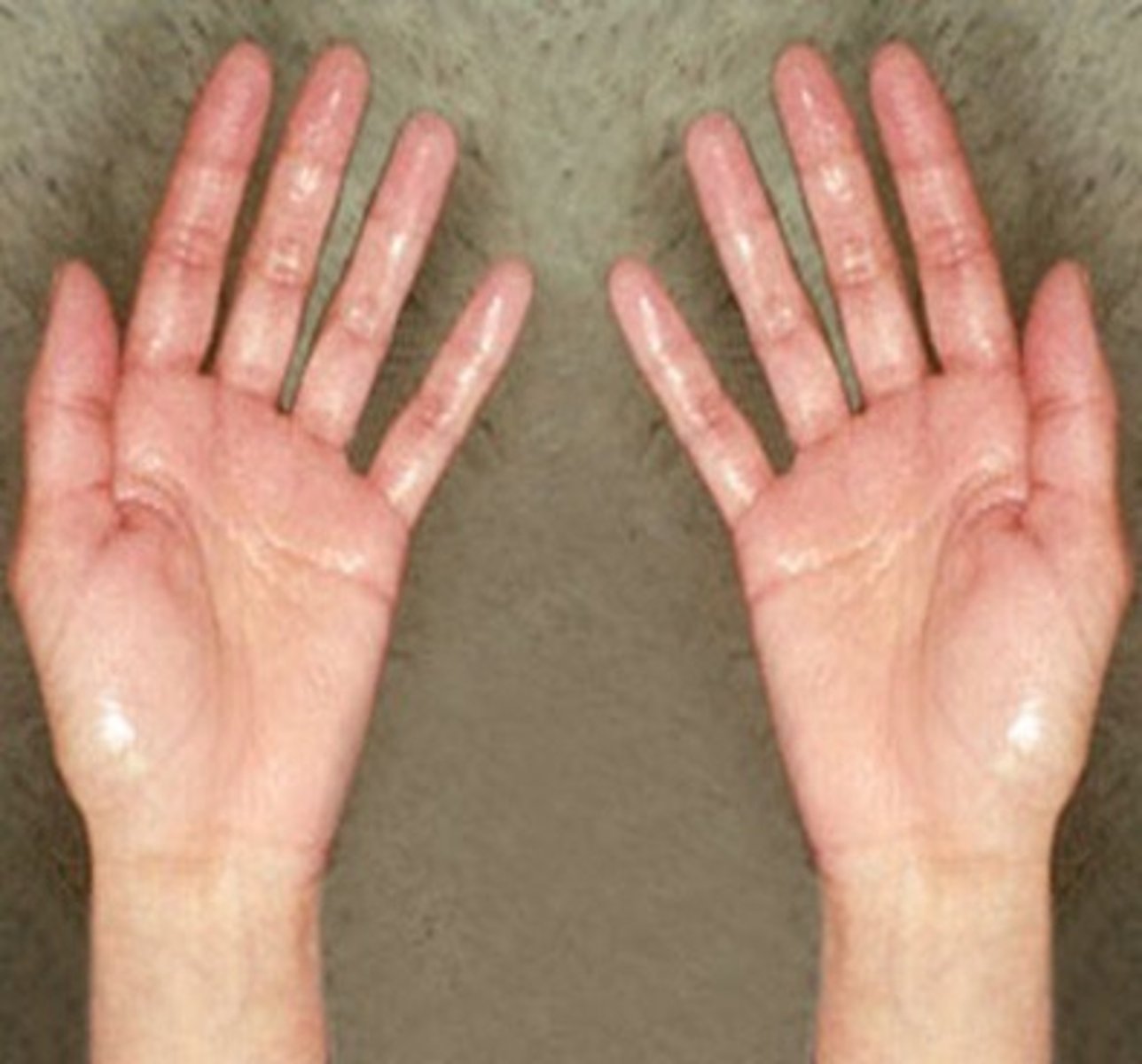 <p>lo lắng về</p>