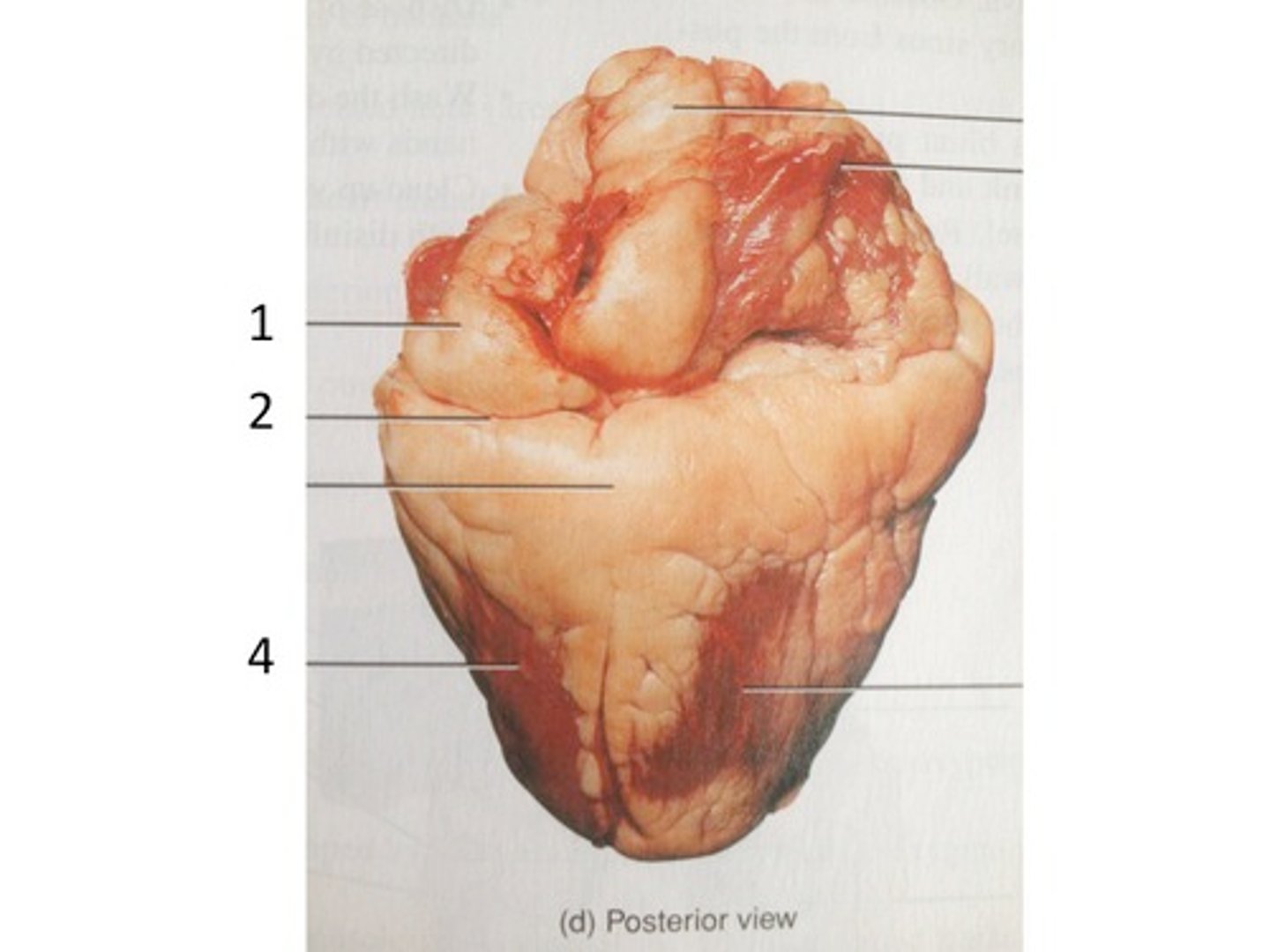 <p>What is 2: the groove? (This is posterior view)</p>