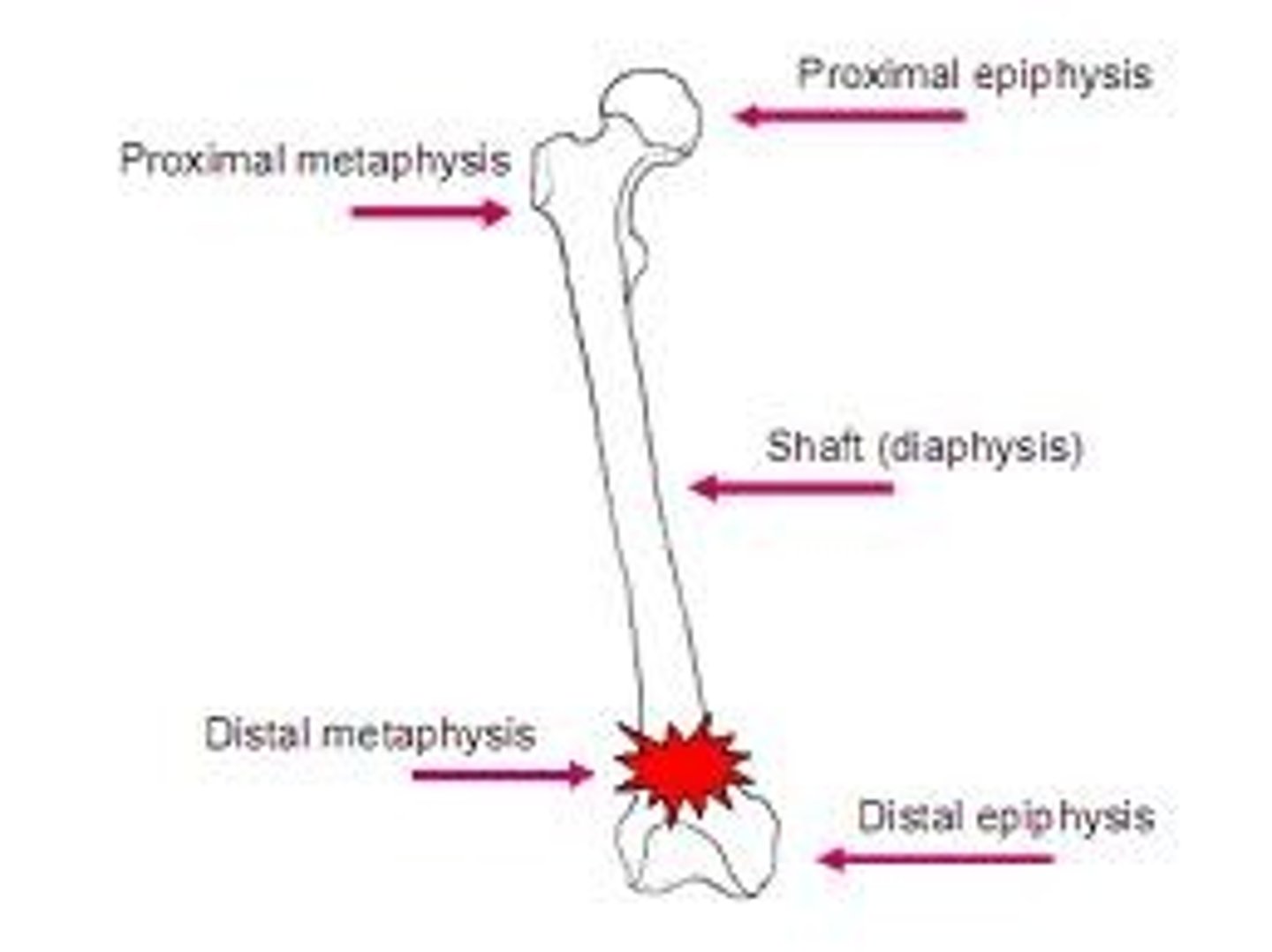 <p>metaphysis and epiphysis with physis (growth plate) between in kids</p>