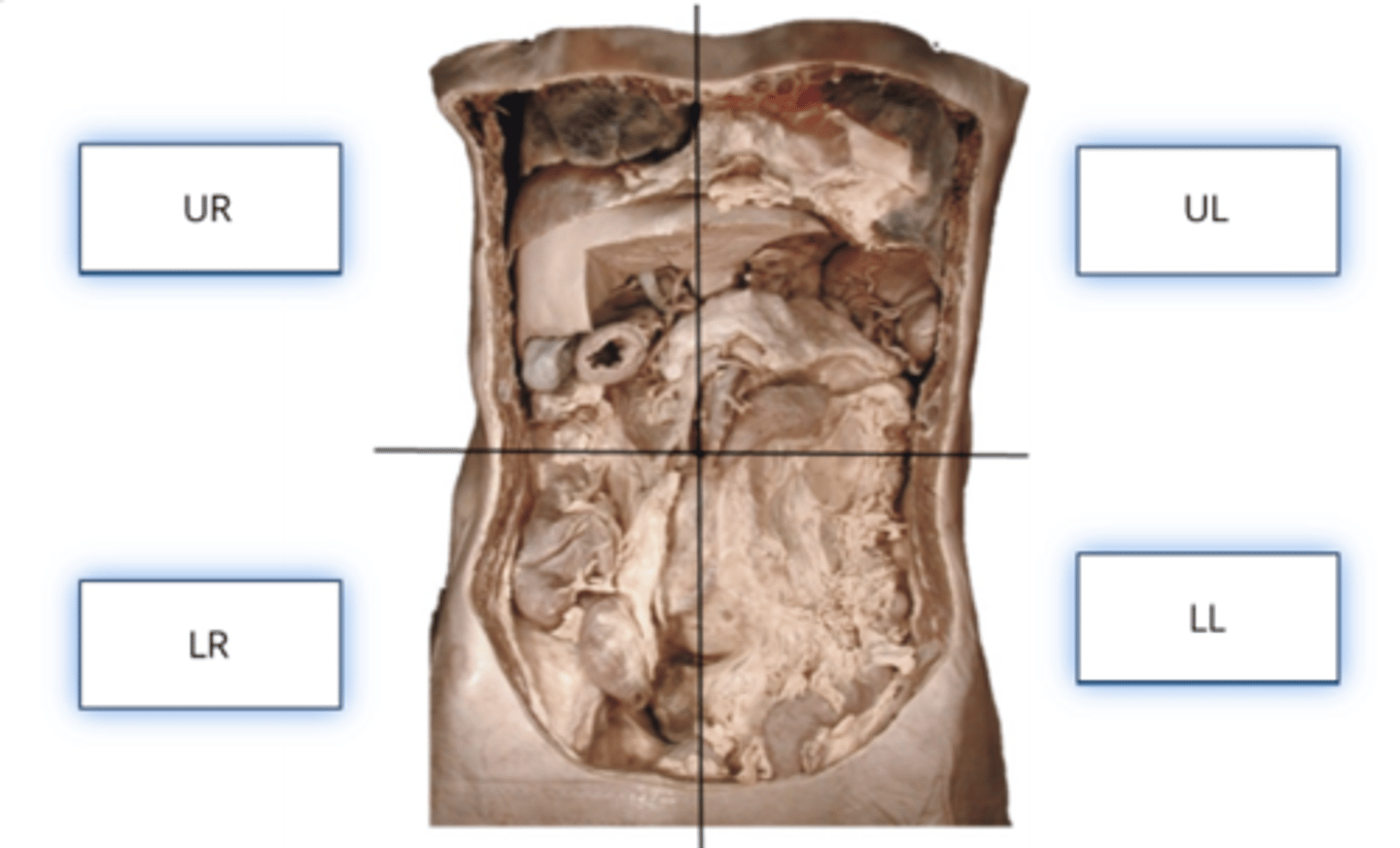 <p>- Abdominal and pelvic cavities can be divided into four quadrants</p><p>- These quadrants are often used in medicine to describe the location of pain, dysfunction, or injury</p>