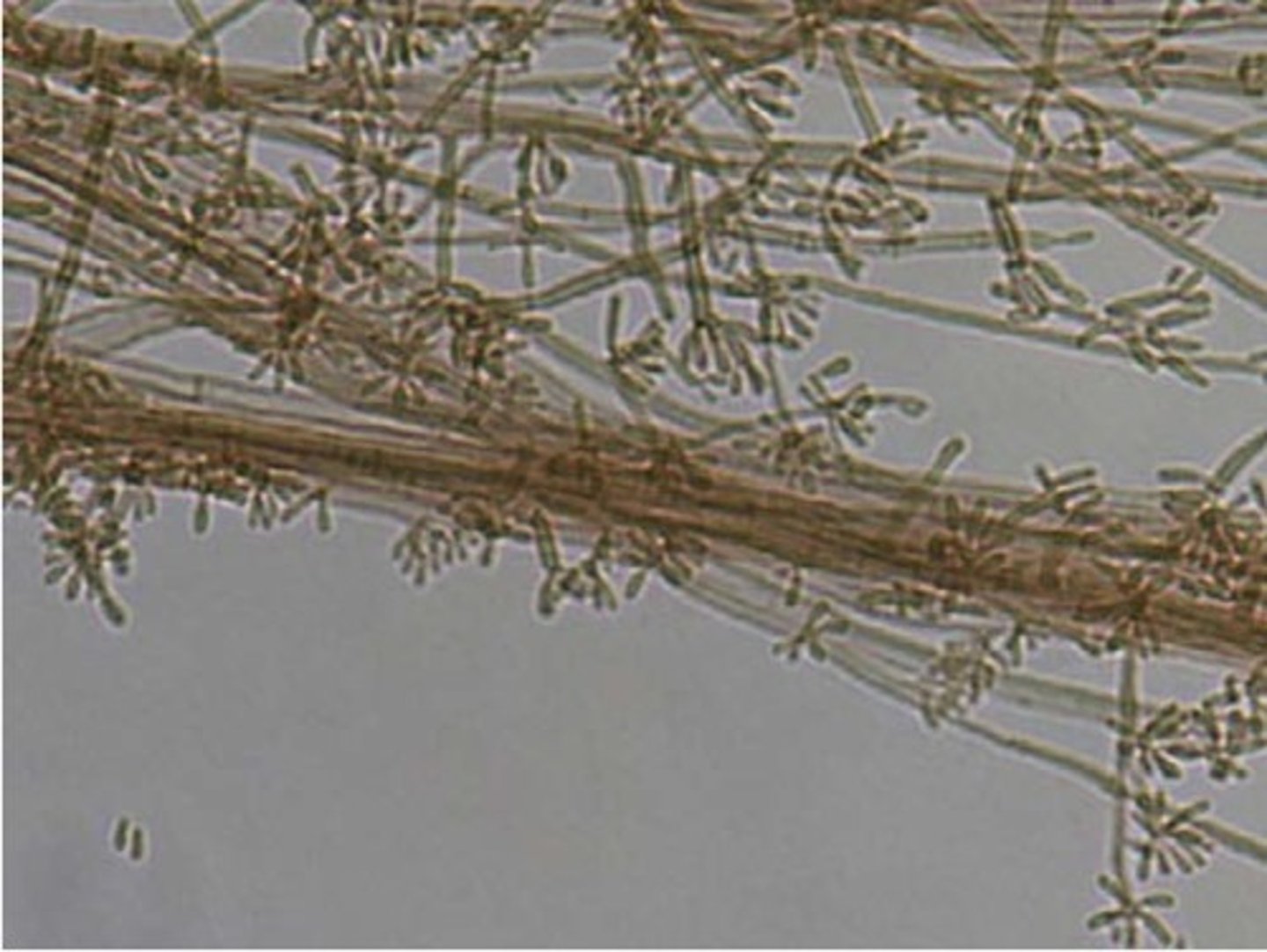 <p>c. Rhinocladiella type</p>