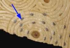 <p>Osteocyte </p>