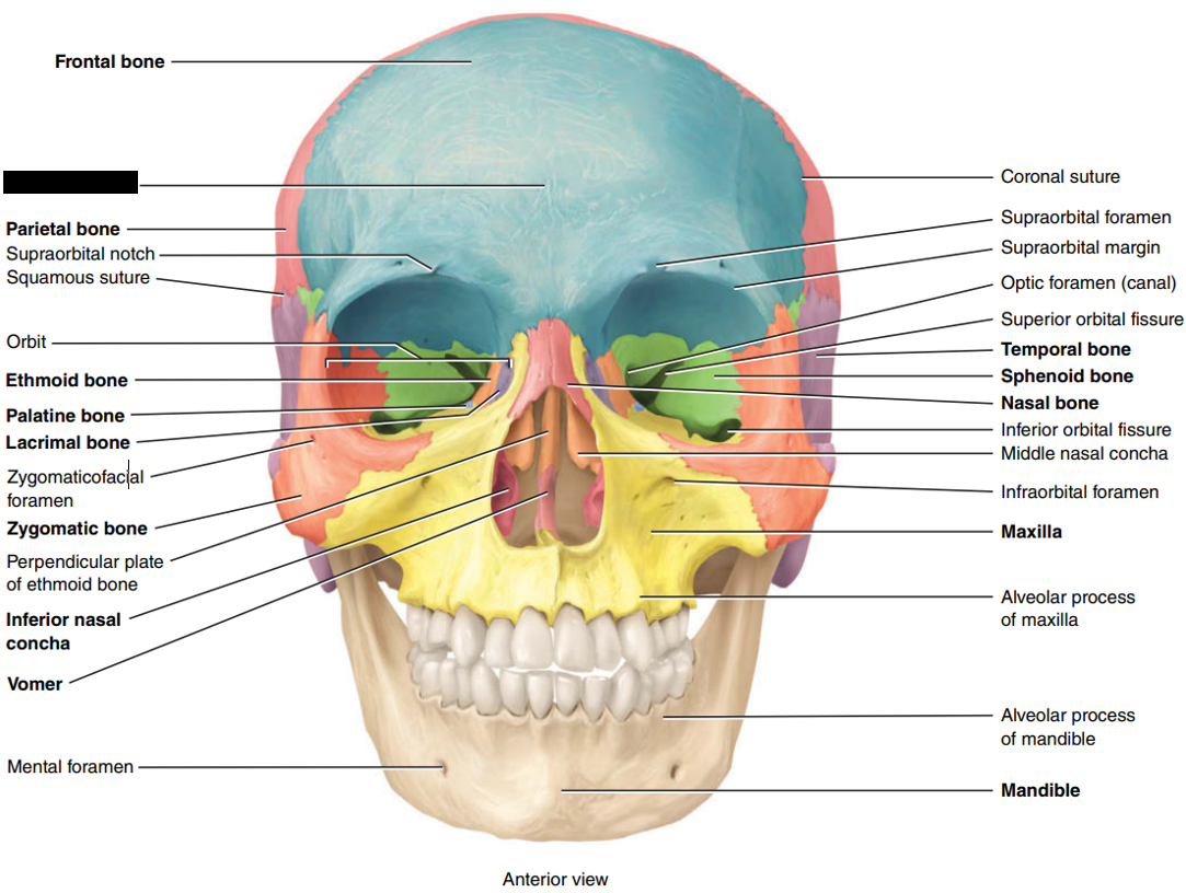 <p>State and identify which part of the cranial bone is being censored.</p>