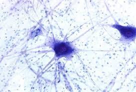 <p>includes long extensions called axons and dendrites, which help transmit signals throughout the body. </p>