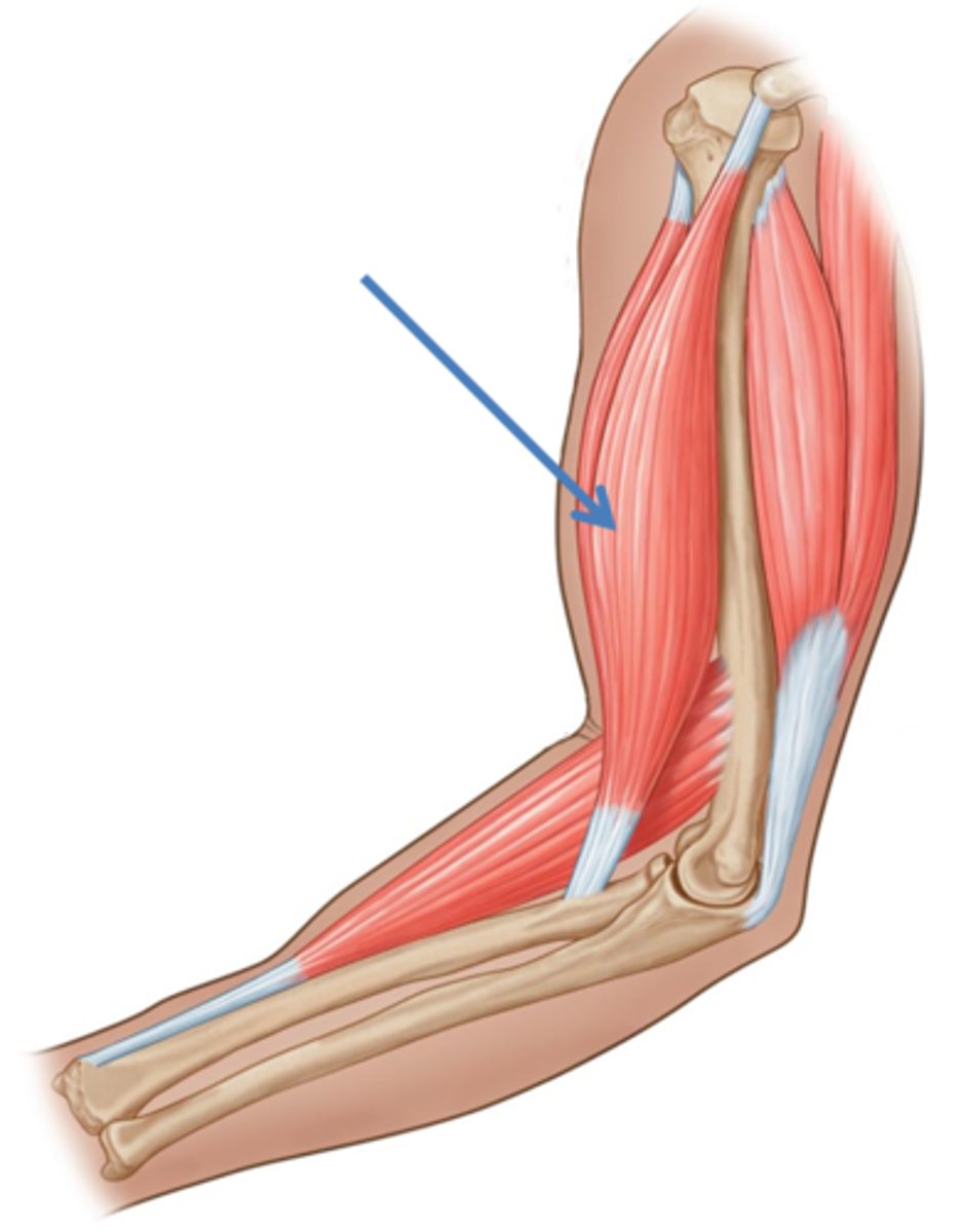 <p>The muscle that is directly responsible for creating the movement produced at a joint.</p>