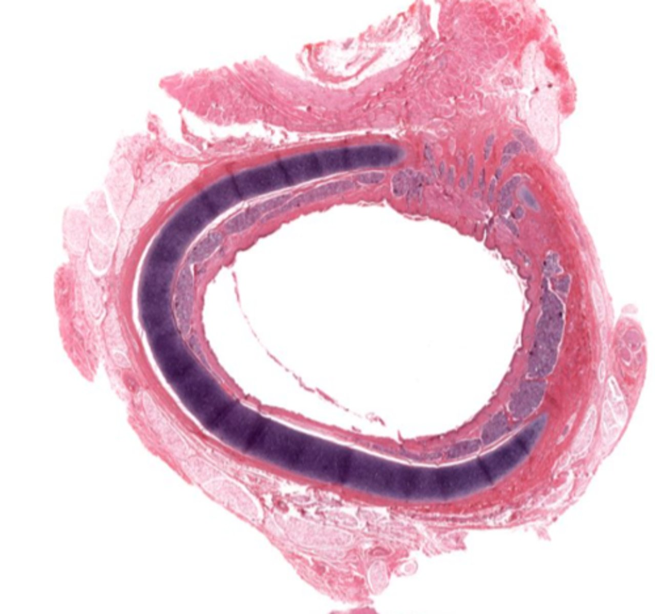 <p>Identify the organ in cross section</p>