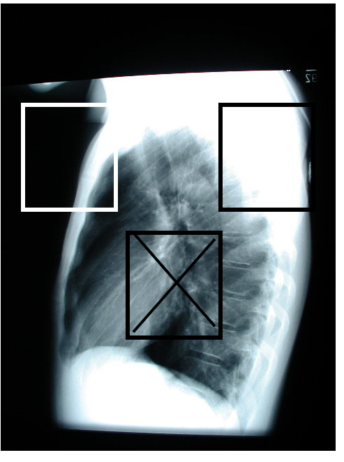 term image