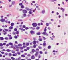<p>What connective tissue cell is shown in the following image?</p>