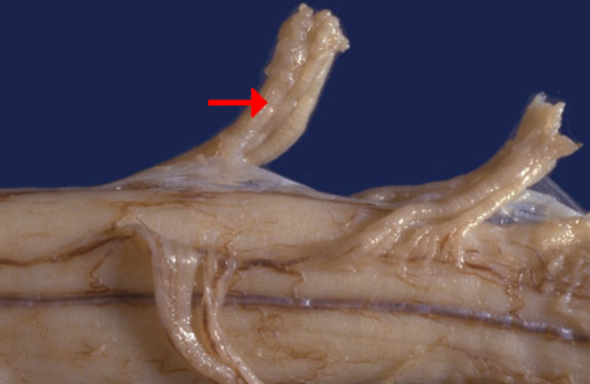 <p>Label this region of the spinal cord</p>