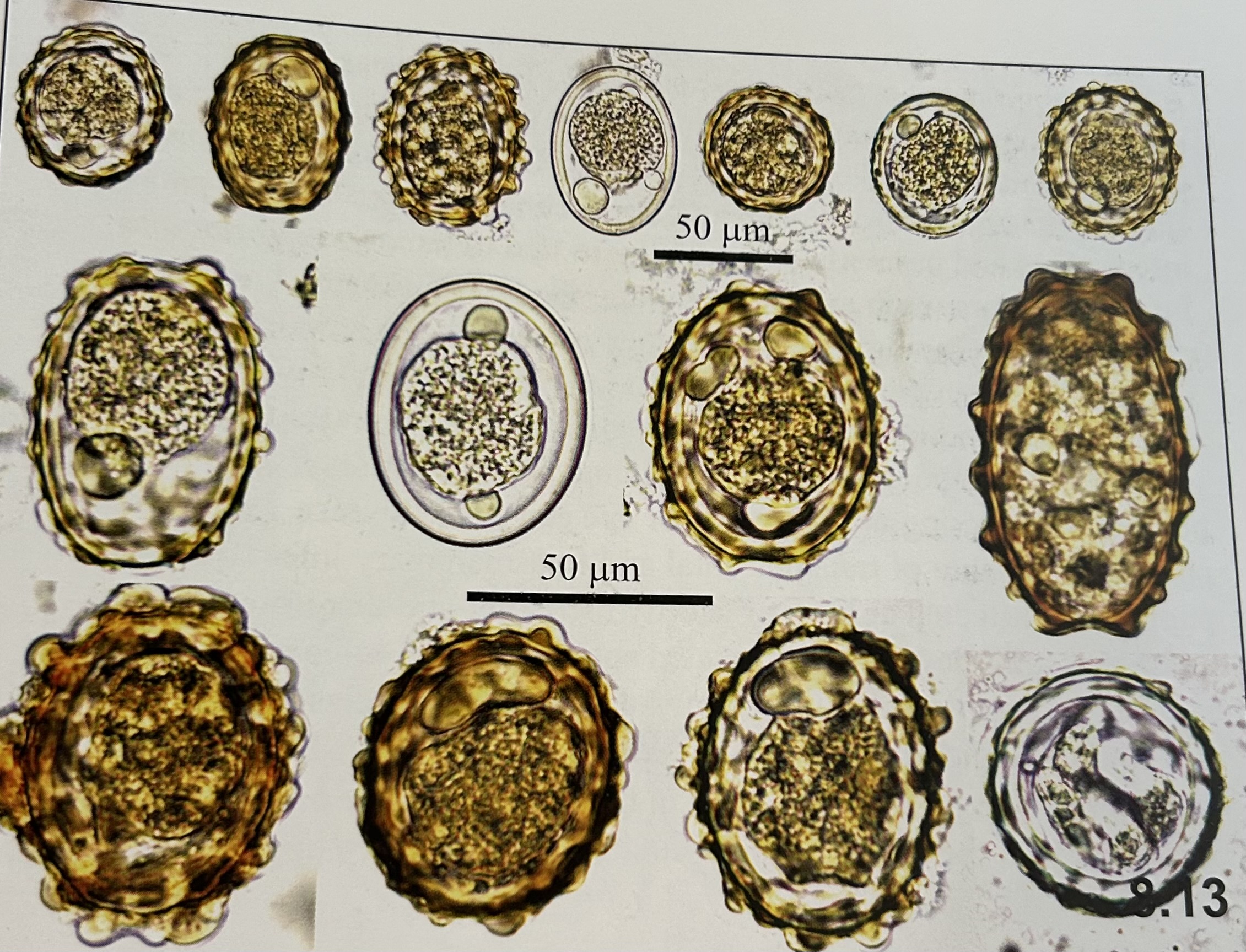 <p>characteristics of </p><p>Ascaris lumbricoides (eggs)?</p>