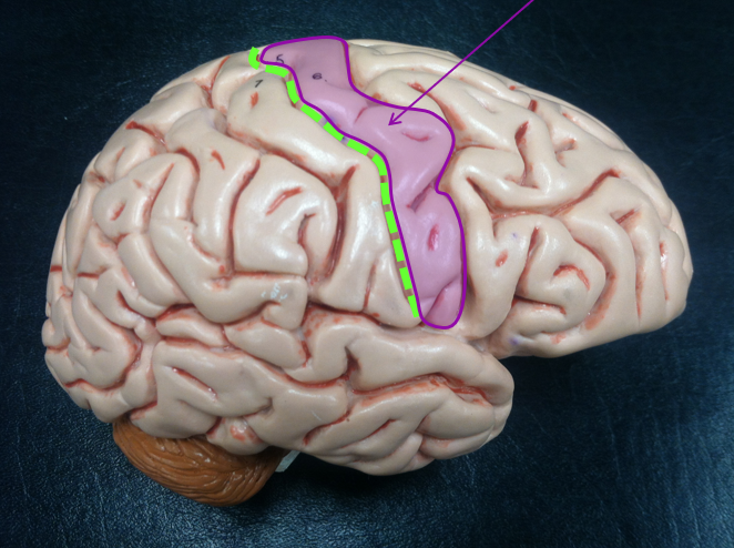 1* motor cortex
