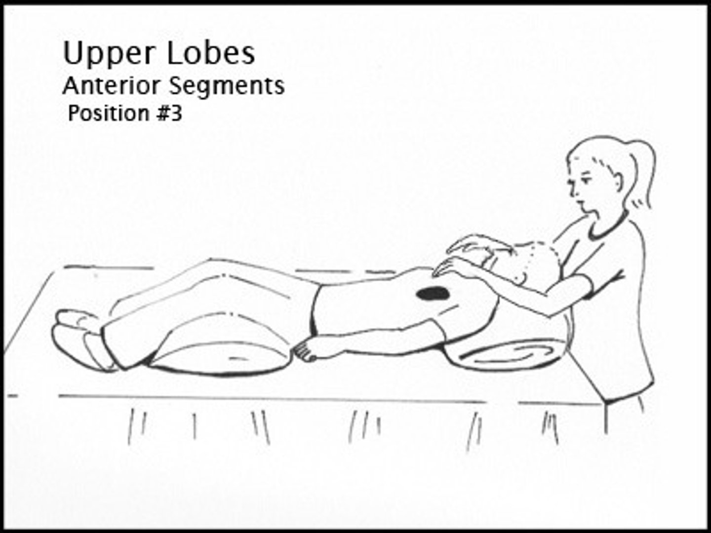 <p>*Patient position*: supine with pillow under knees.</p><p>*PT*: percussion between clavicle and nipple</p>