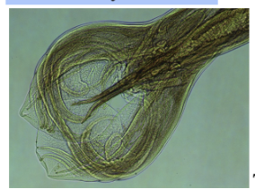 <p><span style="background-color: transparent;"><span>&nbsp;lobular modification of the male posterior end, which is highly elaborated in some nematodes, e.g; those in order stronglyida. It is a distinctive clasping organ with finger-like projections (“birsal rays”) that have sensory function&nbsp;</span></span><br></p>