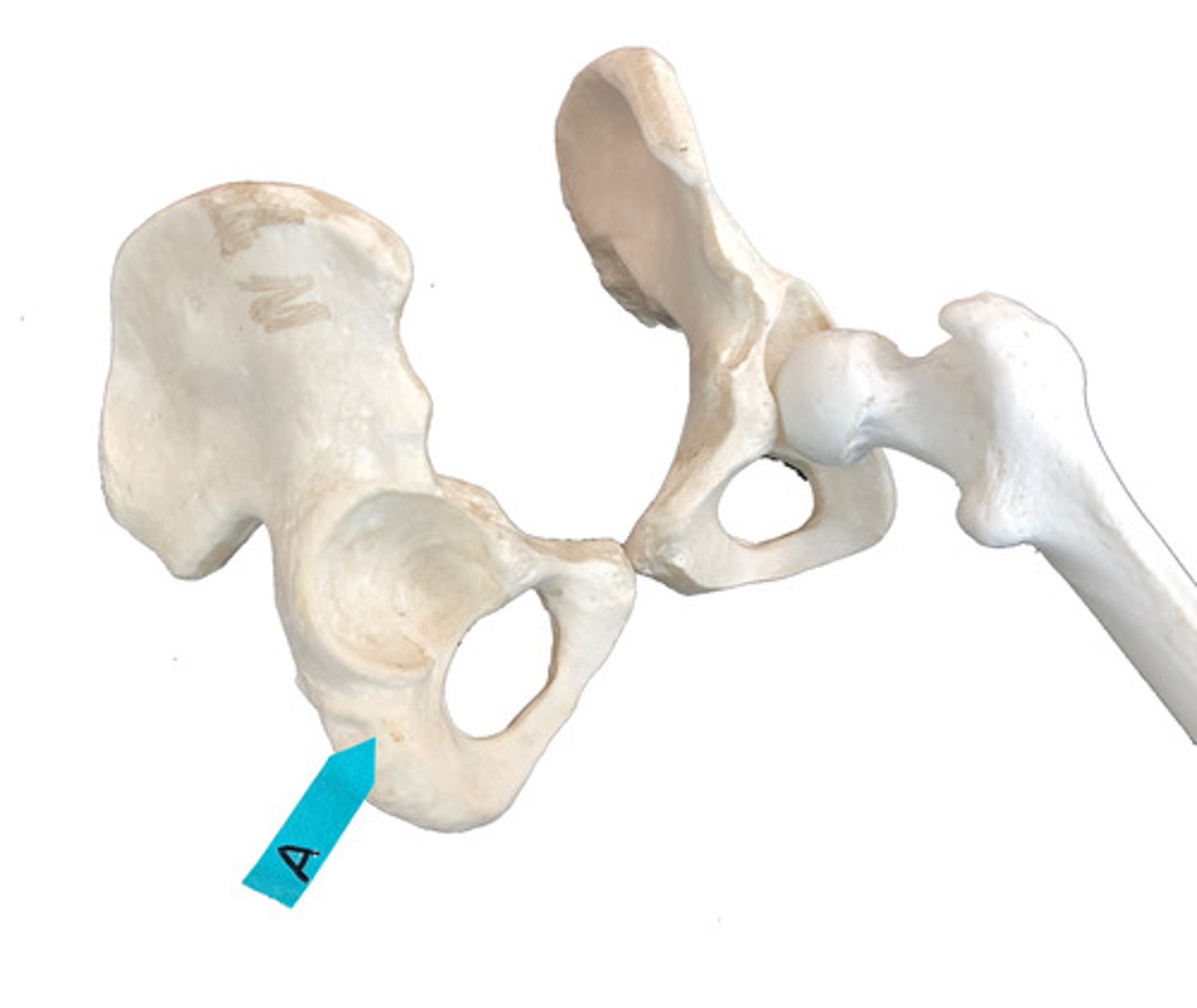 <p>Identify this bone that is one of 3 bones that fuse to form the coxal bone.</p>