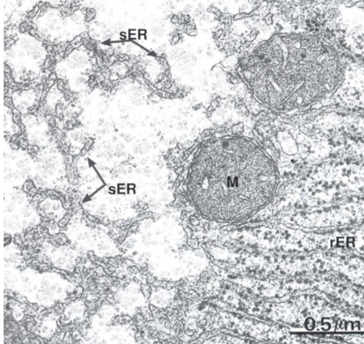 <p>The two types of Endoplasmic Reticulum are rough ER and smooth ER. <mark data-color="yellow" style="background-color: yellow; color: inherit">Rough ER, with ribosomes on its surface,</mark><mark data-color="red" style="background-color: red; color: inherit"> is involved in protein synthesis, while smooth ER functions in lipid synthesis, membrane synthesis, and repair.</mark></p>