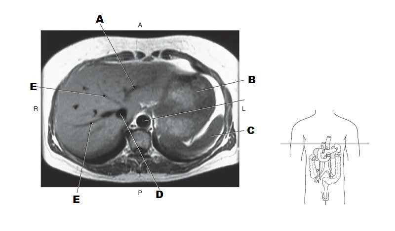 <p>E</p>