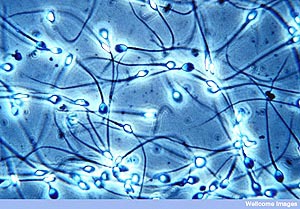 Male sex cell in animals with half the normal number of chromosomes.