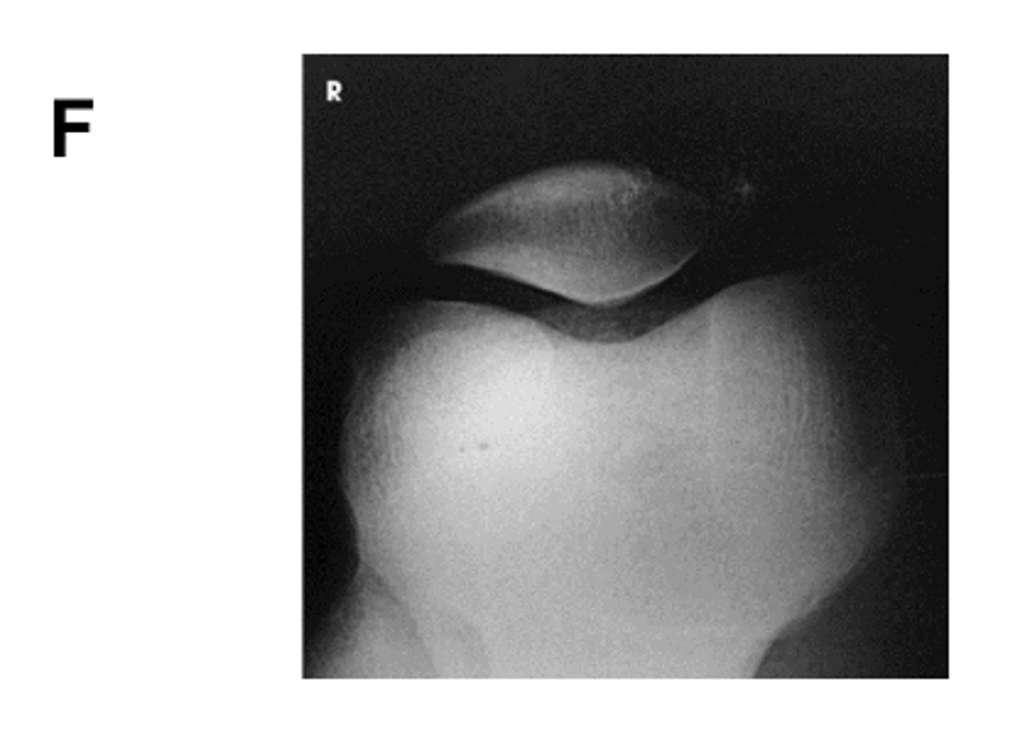 <p>Identify the projection:</p>