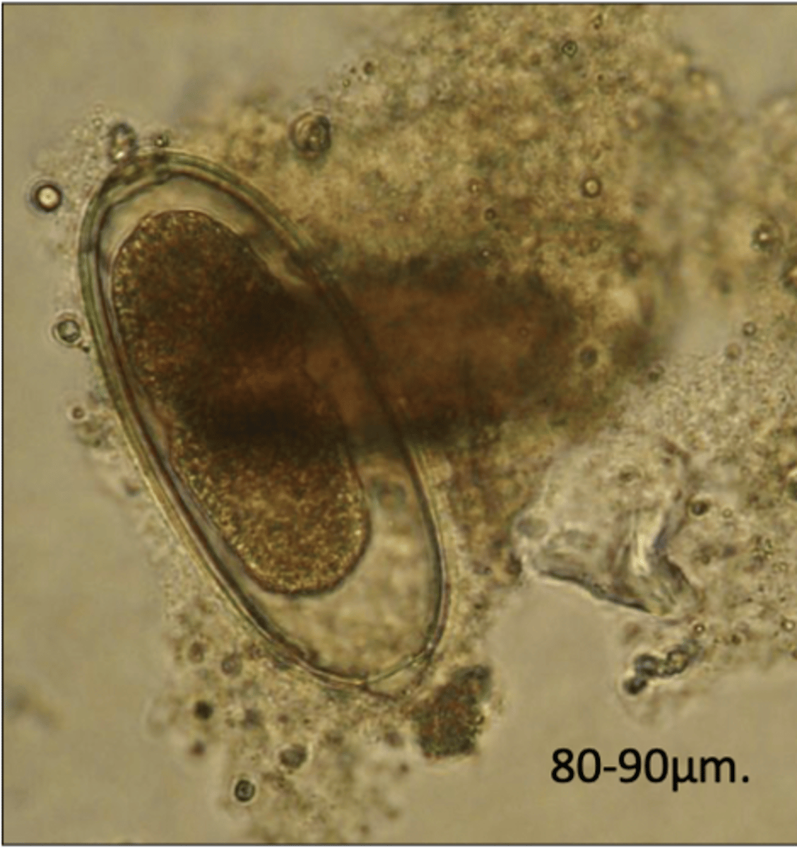 <p>What egg does this parasite belong to? What characteristic/s did you use to identify it?</p>
